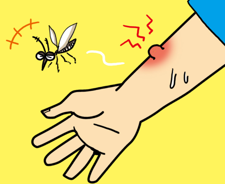 虫刺され 種類、症状や対処法！ブヨ・ハチ。